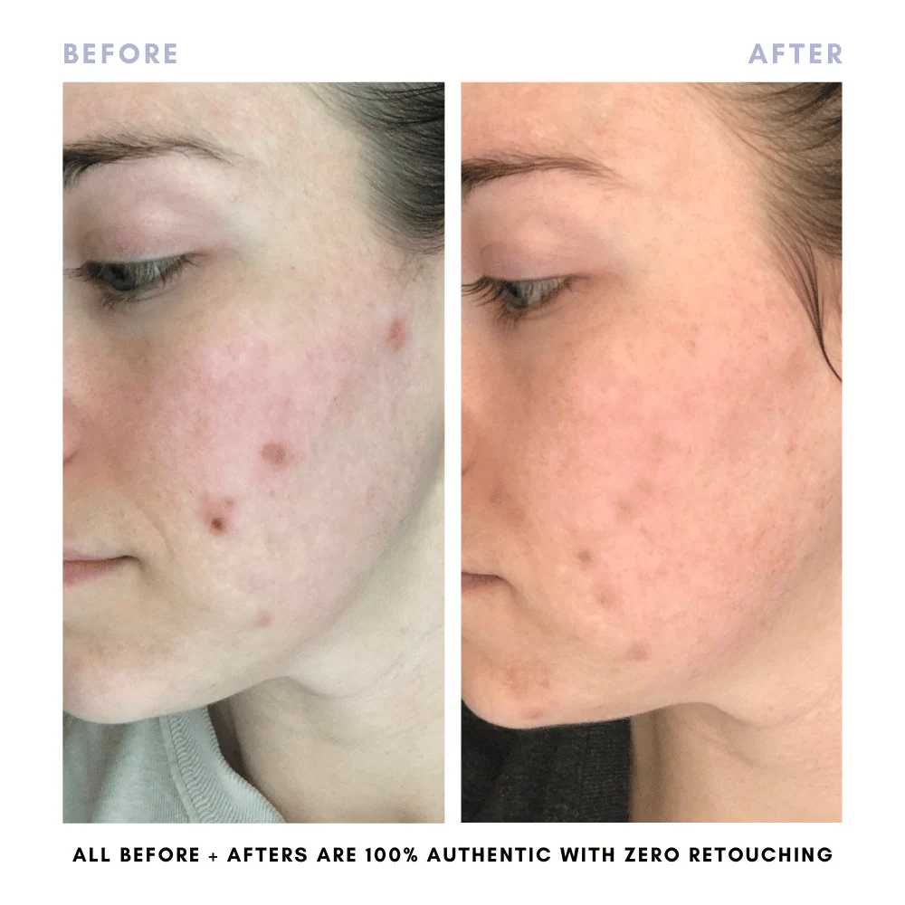 The Double Cleansing Duo - Image 9