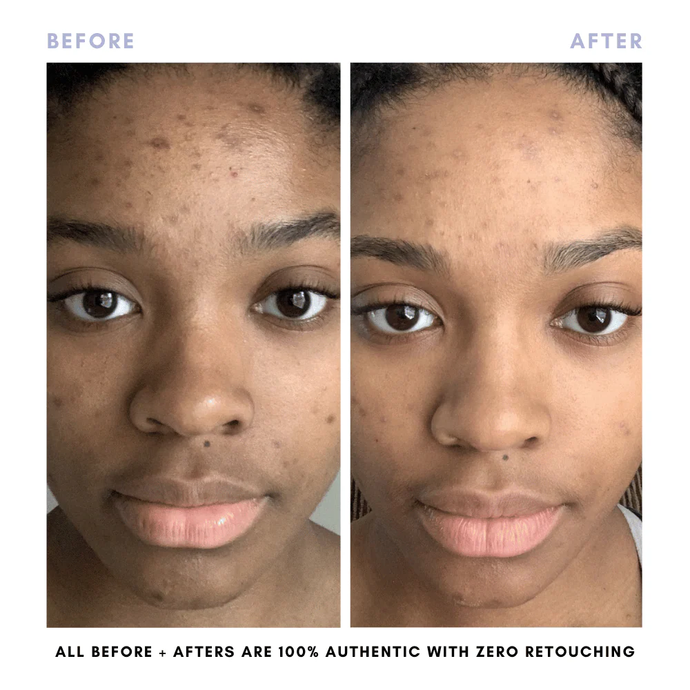 The Juicy Skin Special (+ FREE Rose Suds Cleanser) - Image 8