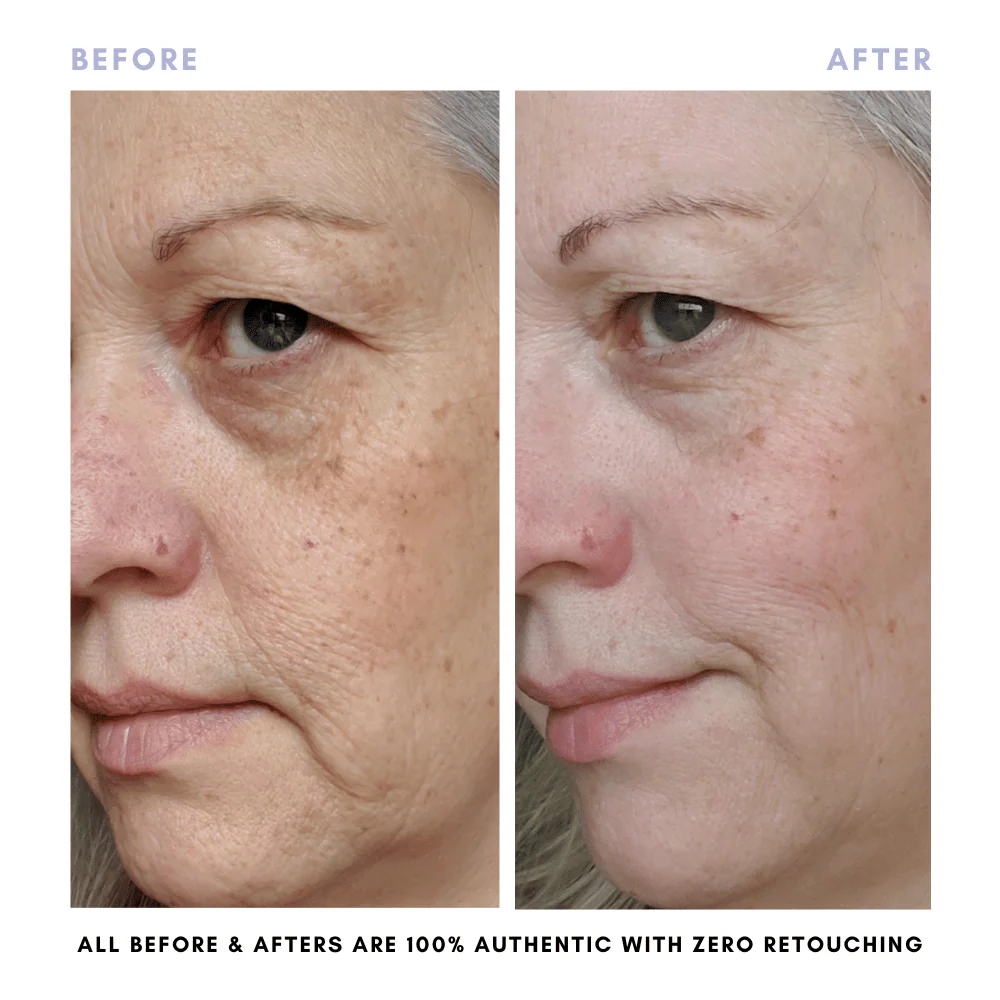 The Skin Reset Starter Kit - Image 14