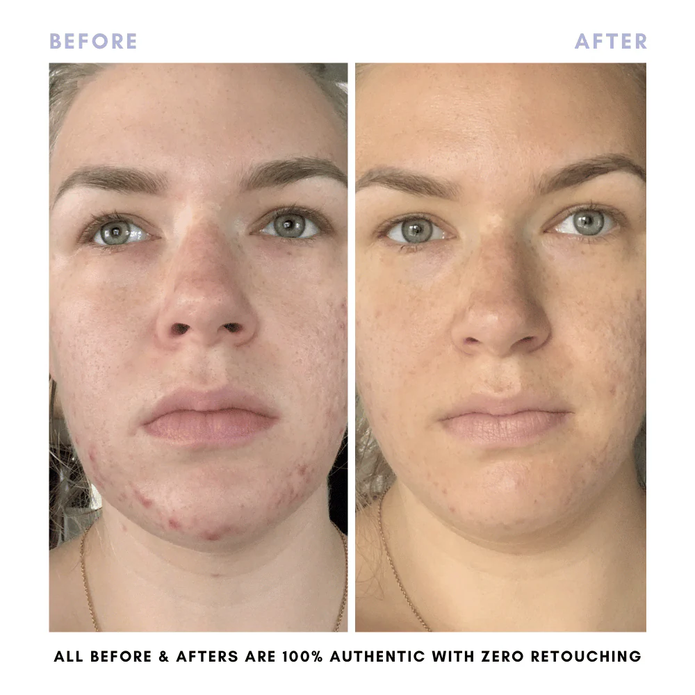 The Skin Reset Starter Kit - Image 16